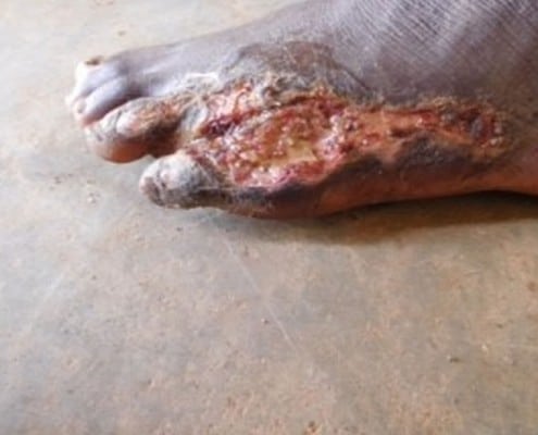 An injured childs foot